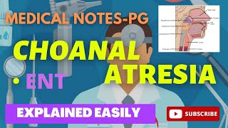 CHOANAL ATRESIA  MEDICAL NOTES PG [upl. by Nnaira]