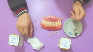 حشوة الاسنان في البيت واحتفظ بالمال✅dentist [upl. by Adnoval181]