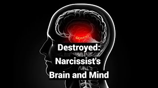 Destroyed Narcissists Brain and Mind Infant Amnesia Psychotic Grandiosity [upl. by Salim]