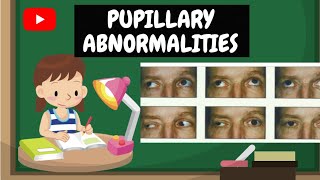 Pupillary Abnormalities  Afferent amp Efferent Pathway Defect  Wernickes pupil  Learn with Neha [upl. by Hearsh]