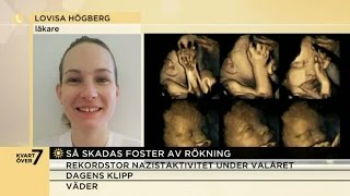 Skrämmande bilder – så reagerar foster på rökning  Nyhetsmorgon TV4 [upl. by Nava]