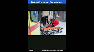 Decorticate vs Decerebrate Posturing Differences ExplainedShorts [upl. by Lakim648]