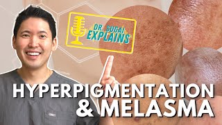 Dermatologist Explains Hyperpigmentation and Melasma  How to Manage it with Top Picks [upl. by Attenrev]