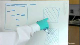 Electrophoresis How to Read Results [upl. by Benis]