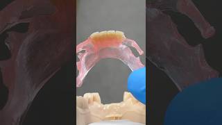 TCS FiberFlex Partial tcsdentalinc tcsdentalinc dental teeth smile lsk121shorts shortvideo [upl. by Zebadiah]