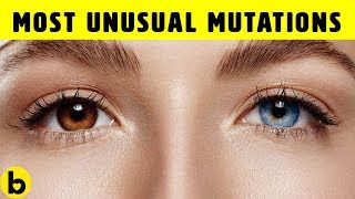 10 Unusual Genetic Mutations Of The Human Body [upl. by Uzzial]