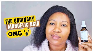 Review Of The Ordinary Mandelic Acid 10  Ha No Irritation Or Burning [upl. by Shatzer]