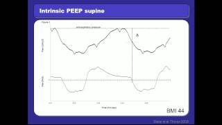 Ventilation in the Obese Patient by Dr Jörg Steier MD D PhD UK [upl. by Aloivaf]