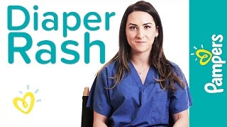 Diaper Rash Treatment and Prevention Nurses Know  Presented by Pampers Swaddlers [upl. by Llehcar948]