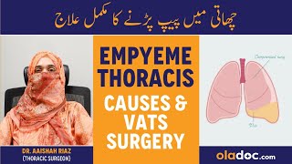 Empyema Thoracis Stages And Advanced VATS Treatment  Chaati Me Peep Parna  Best Chest Surgeon [upl. by Salman977]