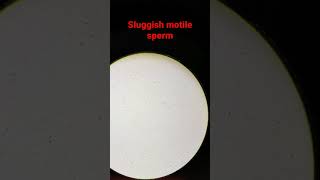 sluggish motile sperm semen analysis [upl. by Aohsoj]