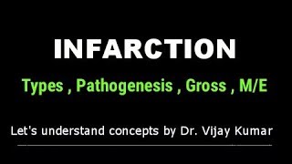 Infarction Pathology  Infarction Types  Infarction Morphology  Pathology Lectures [upl. by Ettelrahc739]