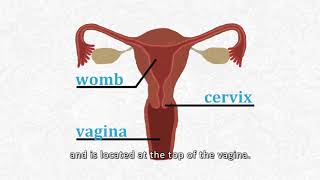 Cervical Cancer Screening [upl. by Chun]