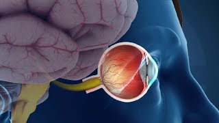 Glaucoma Symptoms Causes Types and Treatment [upl. by Ytinirt]