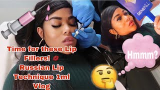 I GOT LIP FILLER  THE RUSSIAN TECHNIQUE 1ML  WHAT TO EXPECT VLOG💉💋 [upl. by Nonez]