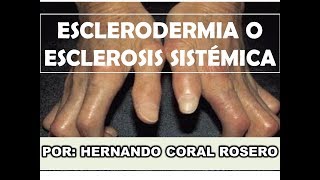 ESCLERODERMIA O ESCLEROSIS SISTÉMICA ENGROSAMIENTO Y ENDURECIMIENTO DE LA PIEL [upl. by Hanford]