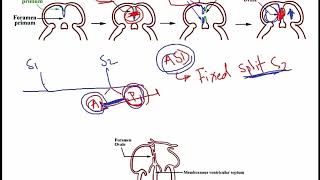 USMLE ACE Video 112 Embryonic development of atrial septum and ventricular septum [upl. by Isola]