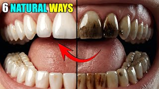 Natural Teeth Cleaning 6 Easy Ways to Remove Plaque amp Tartar Buildup at Home [upl. by Eillor]