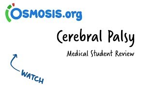 Cerebral Palsy  Clinical Review [upl. by Aretse918]