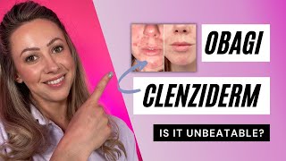 Obagi CLENZIderm MD System  UNBEATABLE ACNE RESULTS [upl. by Nylad]