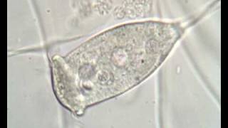 Vorticella sp in activated sludge [upl. by Enehs394]