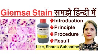 Giemsa stain in Hindi  principle  procedure  result  MLT  histopathology  Haematology [upl. by Kamat417]