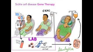 Sickle Cell Disease Past Present Future and Gene therapy [upl. by Aneer293]