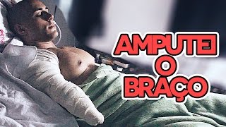 quotLéo Araújo AMPUTA BRAÇO POR ÓLEO MINERALquot [upl. by Lerrej882]