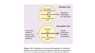 LYMPHOID NEOPLASMS Lecture 5 By Dr Rafiq Cheema Class 4th year [upl. by Anilam]