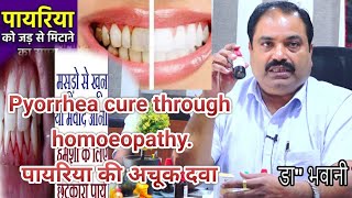 Pyorrhea cure through homoeopathyपायरिया की अचूक दवाDr bhawani Shankar PatnaPyorrhea पायरिया दवा [upl. by Oigaib]