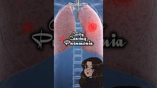 CavityCausing Pneumonia causativeorganisms shorts medicalshorts [upl. by Photina]