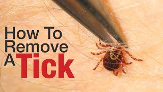 How To Remove A Tick [upl. by Vijnas252]