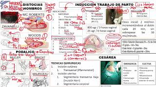 8 INDUCCIóN TRABAJO DE PARTO [upl. by Eleanor]