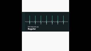 Atrial fibrillation 🆚 Atrial flutter on ECG [upl. by Kaye]