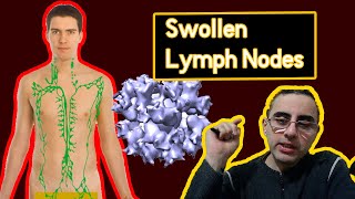 Swollen Lymph Nodes Top 5 Causes Explained [upl. by Sukey]