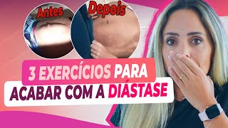 Os 3 MELHORES EXERCÍCIOS para ACABAR com a DIÁSTASE ABDOMINAL [upl. by Edrei]