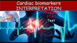 Lecture 8 2 Cardiac Enzymes  Interpretation [upl. by Mario]