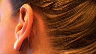 What Causes Ringing in the Ears  Ear Problems [upl. by Ennoid]