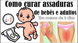 Como curar assaduras​ do bebê por completo em 3 dias [upl. by Ahseuqram]