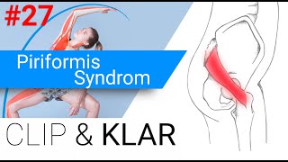 Piriformis Syndrom erklärt  Überlastung der Hüftaussenrotatoren [upl. by Derf]