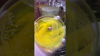 microbiology bacteria fungi microorganisms microbiologist parasites experiment microscopic [upl. by Ysnap]