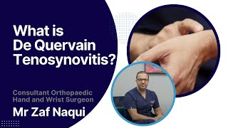 What is De Quervain tenosynovitis [upl. by Adrell]