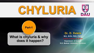 CHYLURIA  What is chyluria amp why does it happen [upl. by Salokin744]