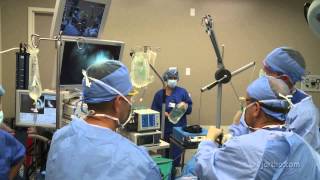 Shoulder Surgery Arthroscopy OR Setup and Patient Positioning [upl. by Orelie]