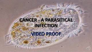 47 Parasites infecting the CNS [upl. by Andromada]