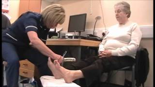 Diabetes Bites Diabetic Foot Examination [upl. by Atteuqnas994]