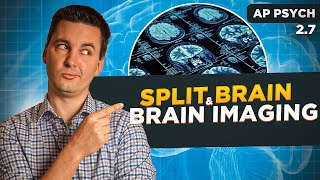 SplitBrain amp Tools for Examining Brain Structure amp Function AP Psychology Unit 2 Topic 7 [upl. by Ueih569]