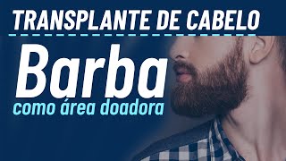 Transplante capilar da barba para a cabeça [upl. by Ibloc]