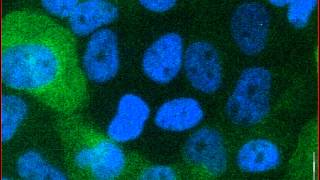 Mitotic catastrophe triggered in human cancer cells by the viral protein apoptin  movie A [upl. by Bowrah]