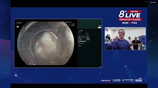 8th online live endoscopy course IECED amp PTCE [upl. by Jolda]